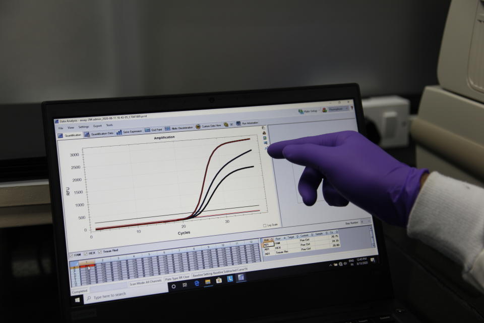 FARIDABAD, HARYANA, INDIA - AUGUST 13, 2020: On a monitor a graph peak shows a corona positive sample on August 13,2020 at the Translational Health Science Technology Institute in Faridabad, India. India has ramped up corona virus testing, with over 2.5 million cases and over 50,000 deaths India is fast emerging as a hub for Covid 19. India has approx. 1400 labs that do testing and has carried out approx 30 million tests. (Photo by Pallava Bagla/Corbis via Getty Images)