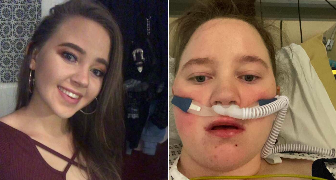 Ffion Barnett was put in an induced coma for five days after testing positive for COVID. (Reach)