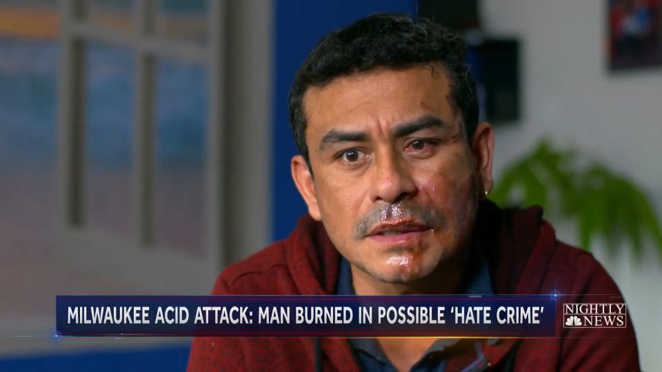 Mahud Villalaz said he was approached by Blackwell initially because of his vehicle's proximity to a bus stop. Blackwell then allegedly started to verbally harass him, calling him an illegal immigrant before throwing acid into his face. (Photo: NBC News)