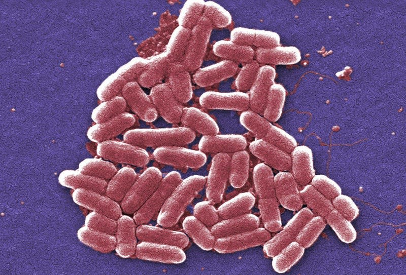 This 2006 colorized scanning electron micrograph image made available by the Centers for Disease Control and Prevention shows the O157:H7 strain of the E. coli bacteria. Bacteria with a special type of resistance to antibiotics are increasingly prevalent in the United States and elsewhere.AP PhotoCDC, JANICE CARR