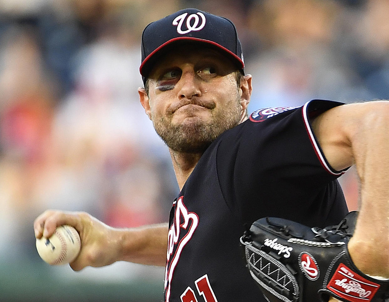 Despite having a broken nose and massive black eye, Max Scherzer opted to take the mound against the Phillies Wednesday -- and he pitched a gem. (Reuters)