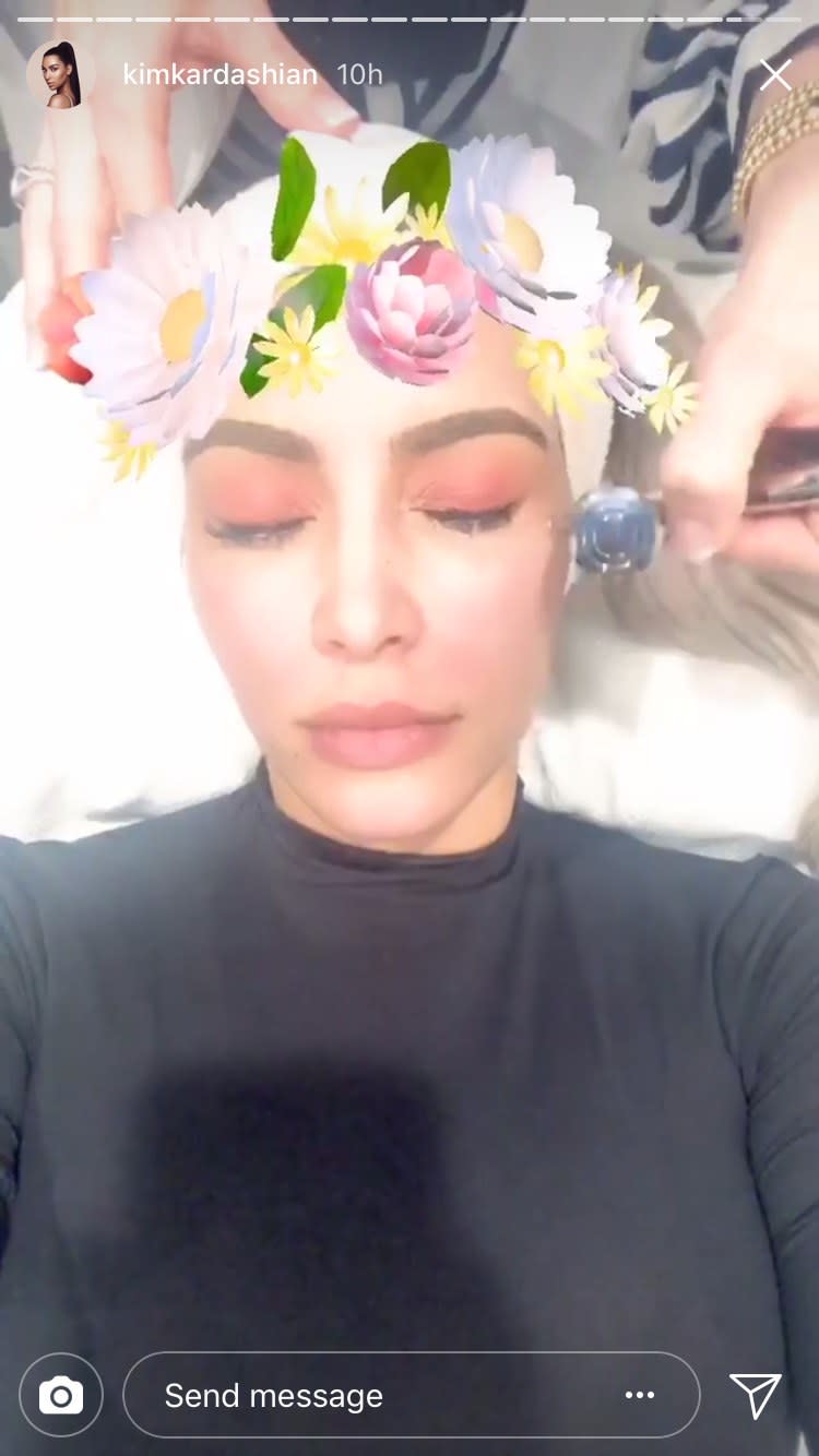 Kim Kardashian recently underwent a laser treatment while wearing a full face of makeup. Here, a dermatologist weighs in why it's important to remove your makeup before treatment.