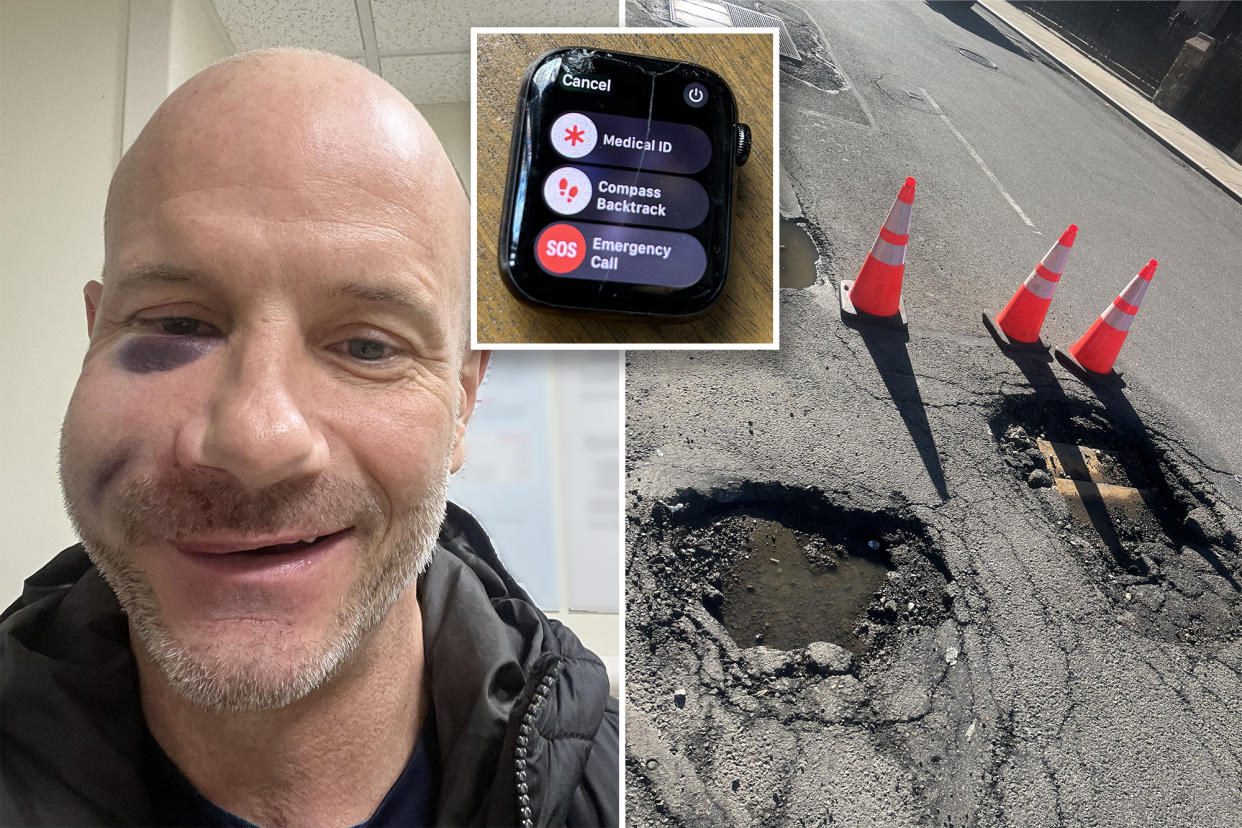 New York real estate broker Eric Zollinger claims his Apple Watch saved his life by dialing 911 following a horrific bike accident that left him looking like a 