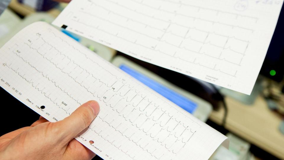 Vorsorgeuntersuchungen an Herz und Gefäßen sind für Menschen mit bestimmten Rheuma-Erkrankungen wichtig - dazu zählt etwa das EKG.