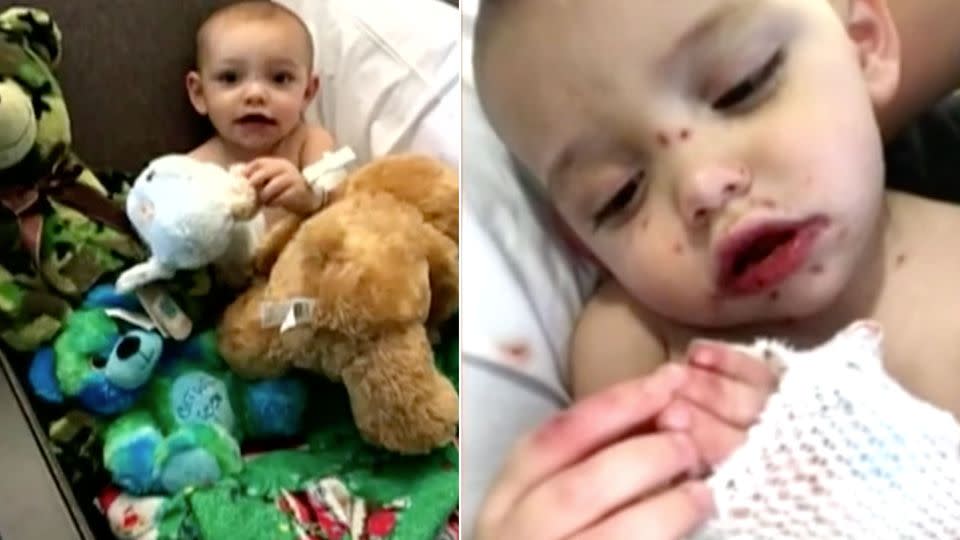 At first doctors thought it was a bad case of hand, foot and mouth disease. Photo: 7 News