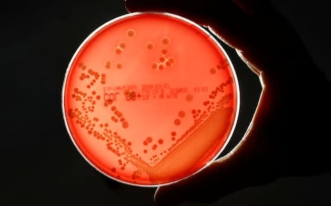 MRSA (Methicillin-resistant Staphylococcus aureus) bacteria strain seen in a petri dish  - Credit: FABRIZIO BENSCH/Reuters