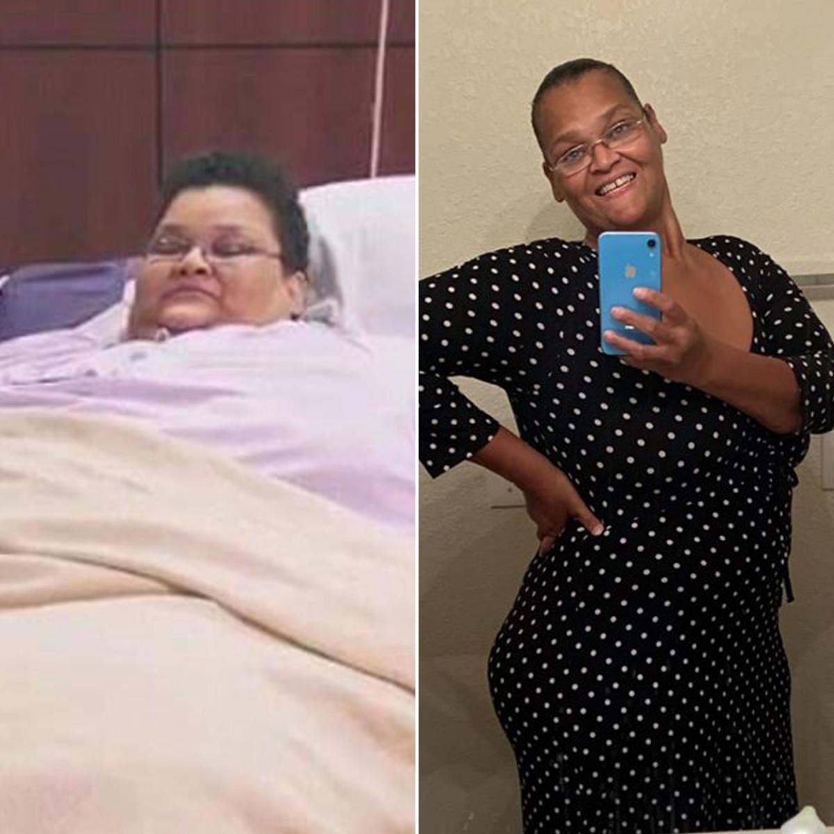 My 600-Lb. Life Dr. Nowzaradan on Why It's Difficult for Patients to Keep  the Weight Off