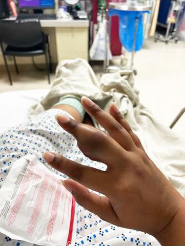 <p>Natalie Garcia</p> Natalie Garcia's tumor in her finger.