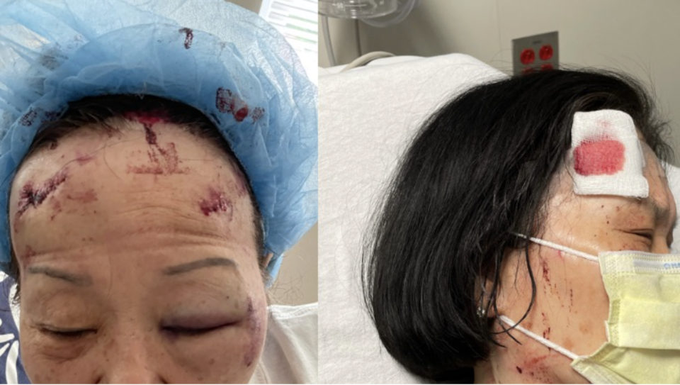 Two Asian women working at a liquor store in Baltimore sustained serious injuries after being attacked by a man with a cinder block.John Yun/gofundme