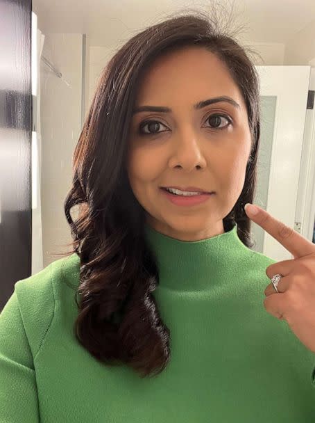 PHOTO: Zohreen Shah was diagnosed with Bell's palsy in January. She's pointing to the side of her face that temporarily could not move (Zohreen Shah/ABC News)