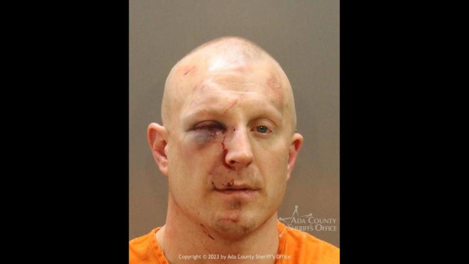 Colt Seward’s booking photo at the Ada County Jail after he was punched in the face by Meridian Officer Donald Heida.