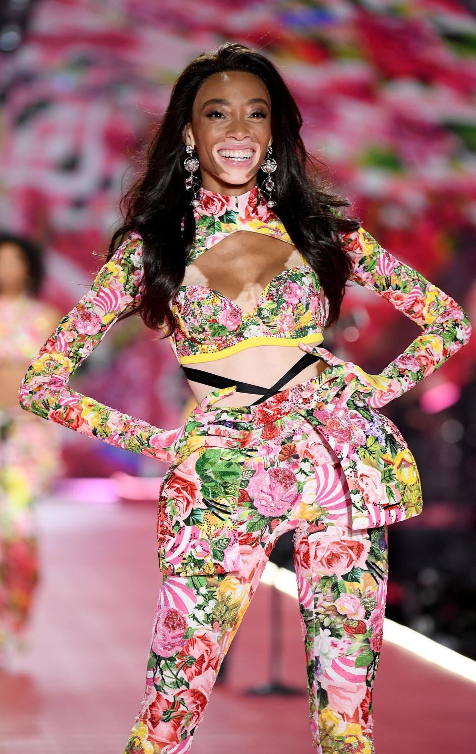 Winnie Harlow