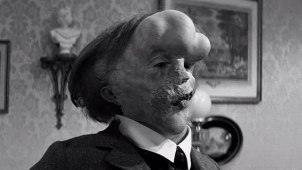 The Elephant Man (1980)