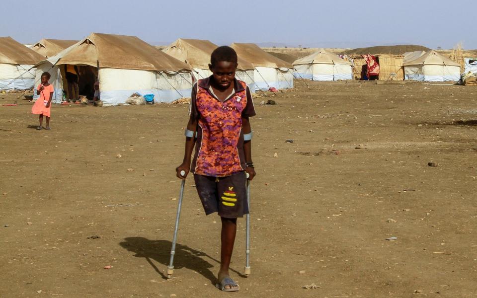 A child missing a leg at the displacement camp after fleeing Khartoum