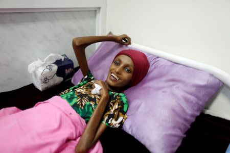 Saida Ahmed Baghili, 18, who has been affected by severe malnutrition, rests on a bed at the al-Thawra hospital in the Red Sea port city of Hodeidah, Yemen, November 17, 2016. REUTERS/Khaled Abdullah/File photo