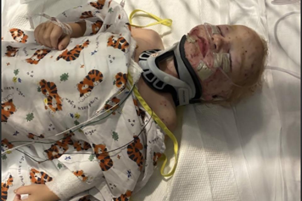 https://www.gofundme.com/f/toddler-tragically-mauled-help-family-recover Toddler Tragically Mauled, Help Family Recover