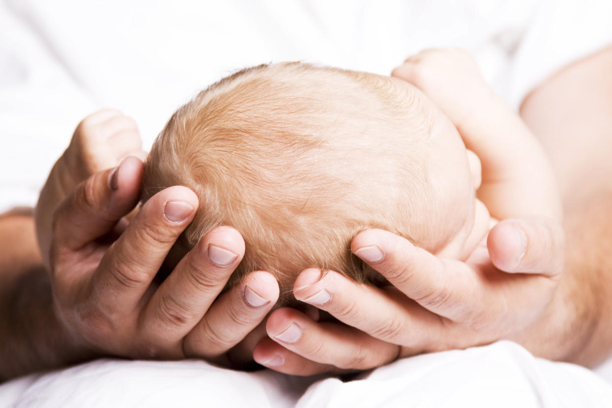 Seventeen children in Spain developed hypertrichosis, which causes excessive hair growth, after ingesting the wrong prescribed drug. (Photo: Getty Images)