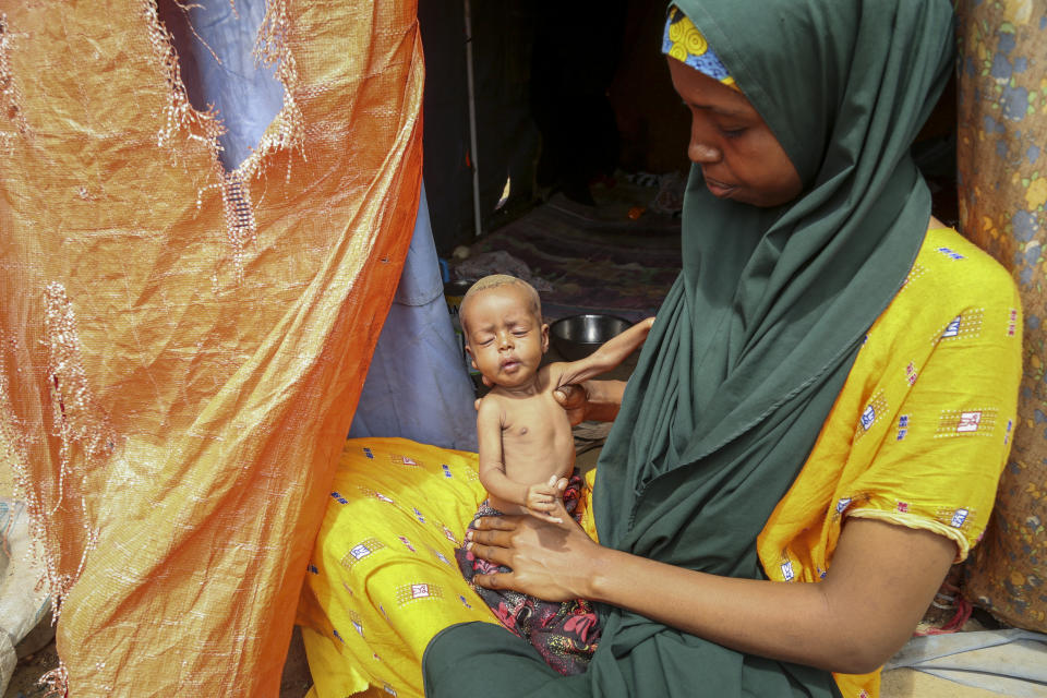 Amina Shuto, 21, who fled the drought-stricken Lower Shabelle area, holds her two-month old malnourished child at a makeshift camp for the displaced on the outskirts of Mogadishu, Somalia Thursday, June 30, 2022. The war in Ukraine has abruptly drawn millions of dollars away from longer-running humanitarian crises and Somalia is perhaps the most vulnerable as thousands die of hunger amid the driest drought in decades. (AP Photo/Farah Abdi Warsameh)