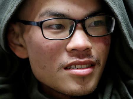 Taiwanese Liang Sheng Yueh smiles as he undergoes treatment at a hospital after being rescued, Kathmandu, Nepal April 26, 2017. Liang Sheng Yueh and his fellow trekker Liu Chen Chun who died were missing for 47 days while on their trek. REUTERS/Navesh Chitrakar