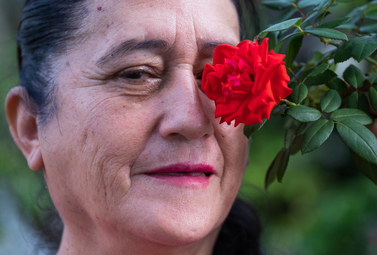 Maria Ovalle of West Palm Beach poses for a picture with a flower over her left eye Tuesday at her home in West Palm Beach, FL. Thanks to Gift of Sight, a program provided by the Eye Associates of Boca Raton with the Caridad Center, Ovalle received free cataract surgery on her left eye, and will receive another surgery on her right eye soon.