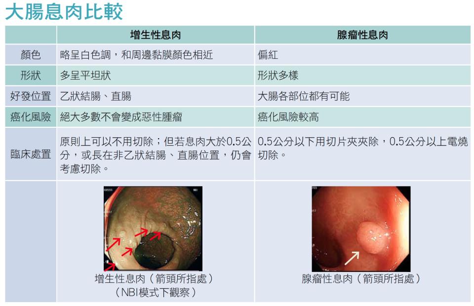 大腸息肉比較