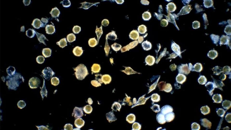 Alexandium cells, the organism that causes "red tide, in a collection of other phytoplankton cells.