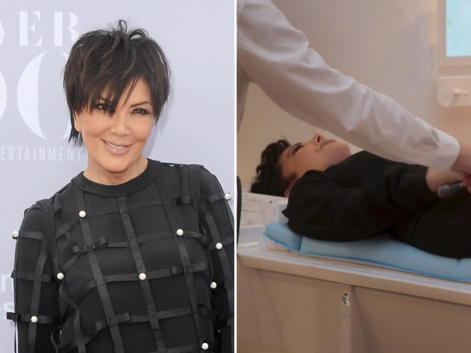 left: kris jenner, smiling and with her fringe falling over her forehead. she&#39;s wearing a black dress and standing in front of a lavender wall; right: kris jenner lying flat on an mri bed, an attendant&#39;s arm situating her