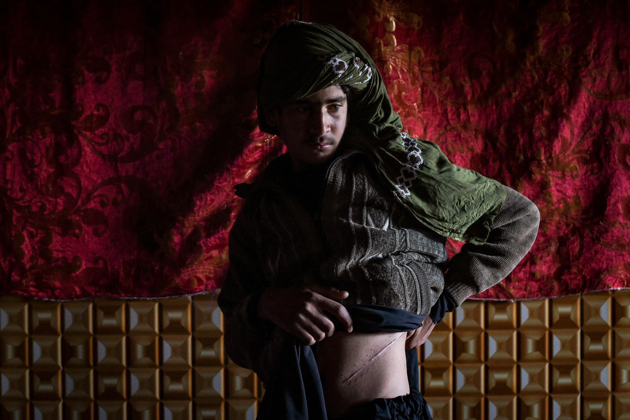 TOPSHOT-AFGHANISTAN-ECONOMY-HEALTH-ORGANS (Wakil Kohsar / AFP via Getty Images file)