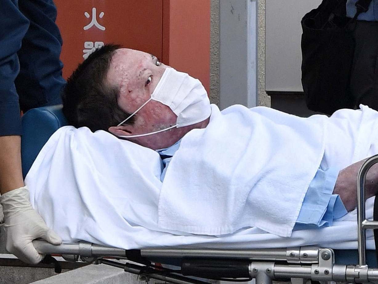 Shinji Aoba, a suspected arsonist who is suspected of killing 36 people at Kyoto Animation in July 2019, is seen on a stretcher as he is carried to Fushimi police station after being arrested in Kyoto: REUTERS