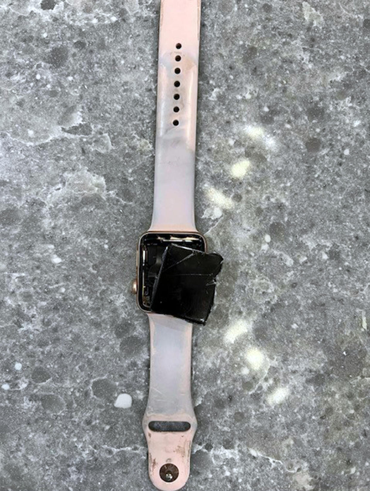 Eggler's Apple Watch exploded during the incident. (Courtesy Emma Eggler)
