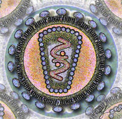 Representación del Virus de Inmunodeficiencia Humana (VIH). <a href="https://commons.wikimedia.org/wiki/File:Human_Immunodeficency_Virus_-_stylized_rendering.jpg" rel="nofollow noopener" target="_blank" data-ylk="slk:Wikimedia Commons / Los Alamos National Laboratory;elm:context_link;itc:0;sec:content-canvas" class="link ">Wikimedia Commons / Los Alamos National Laboratory</a>