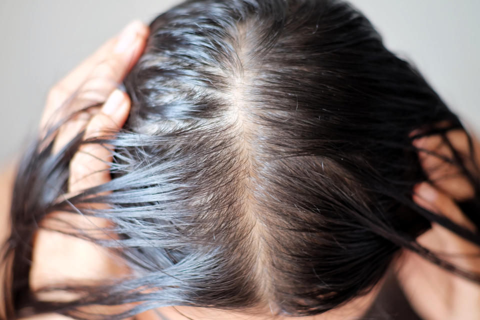 These are the best exfoliating scalp treatments to try