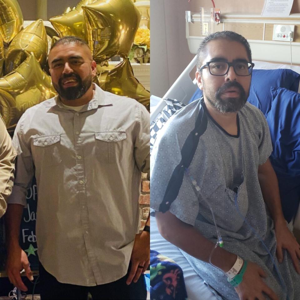 Jose Leon before and during his illness.