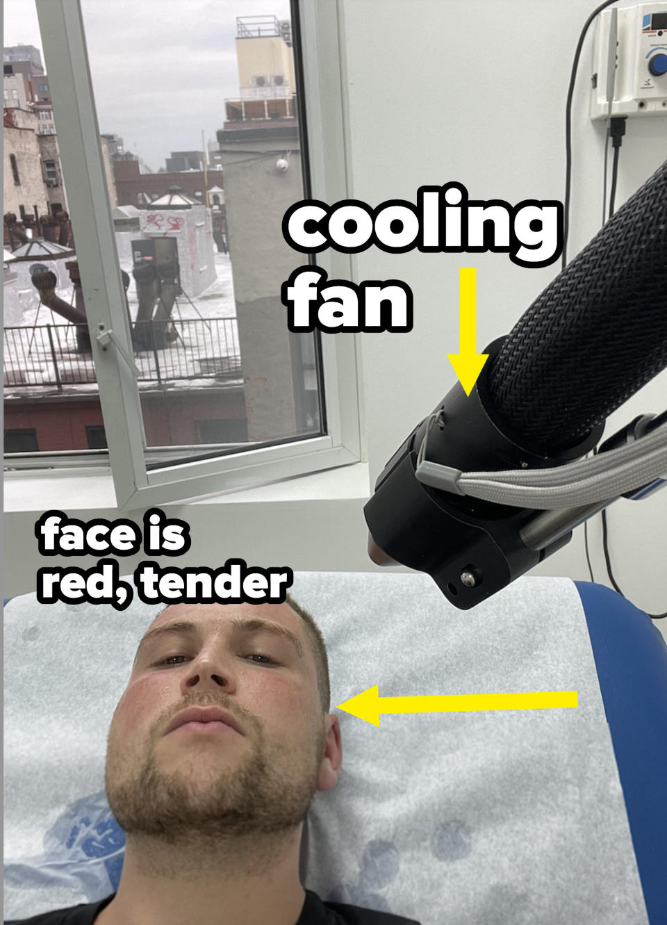 Cooling fan over Ryan's skin