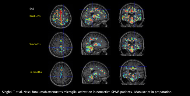 Six-Month PET Scan