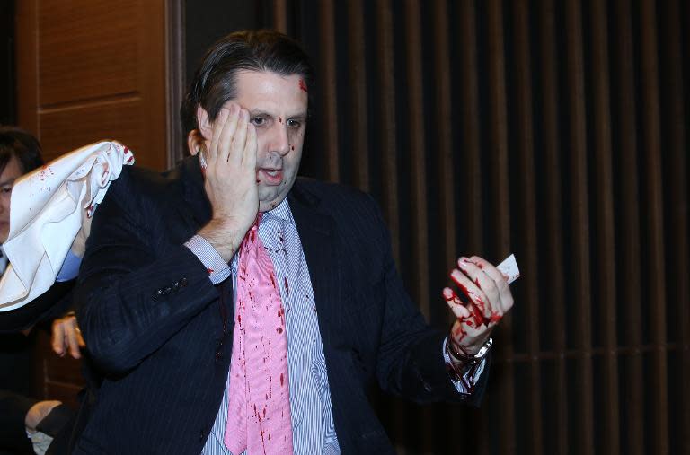 US ambassador to South Korea Mark Lippert covers a wound to his face as he leaves the Sejong Cultural Institute in Seoul on March 5, 2015 after he was attacked by a blade-wielding assailant shouting anti-war slogans