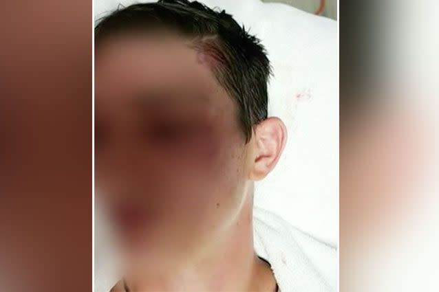 A 16-year-old was rushed to hospital after suffering head injuries. Source: 7News