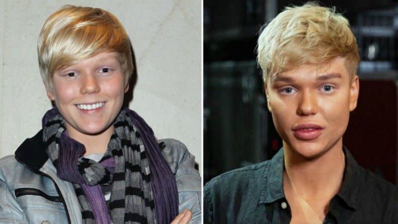 Jack Vidgen transformation 