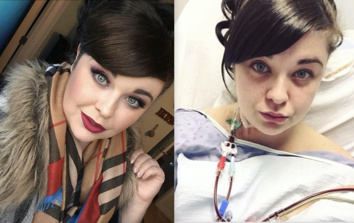 Miranda Edwards with makeup on (left) vs. in hospital (right)