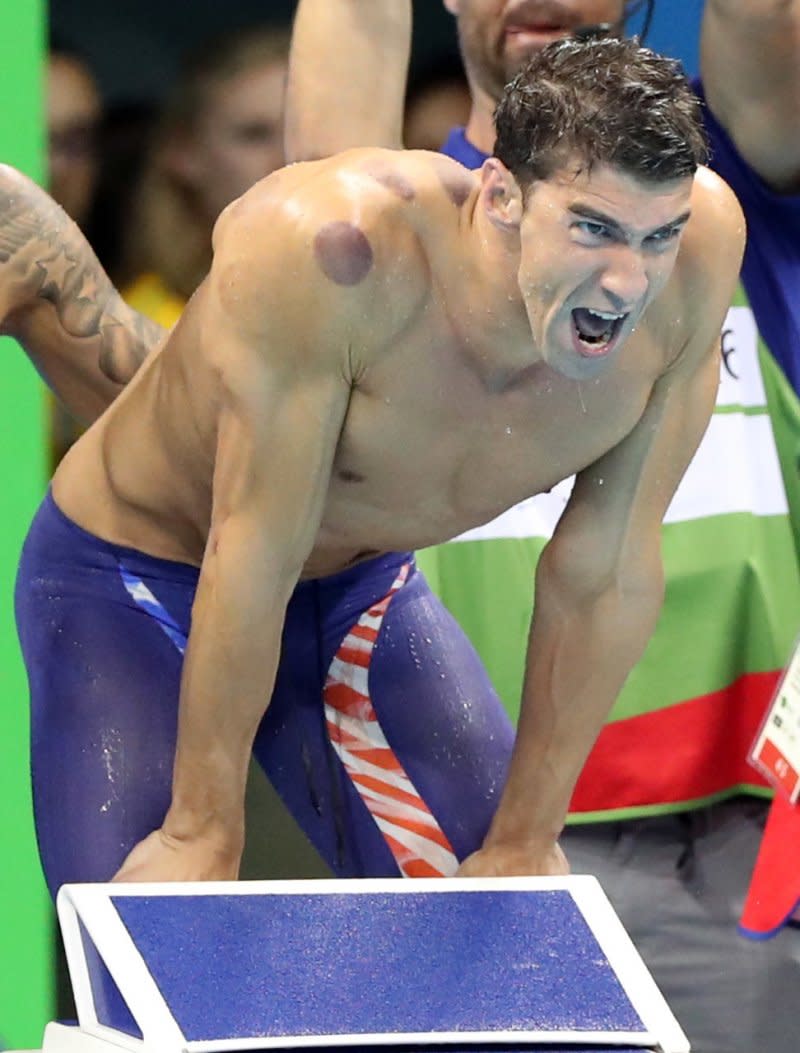 征戰里約奧運的游泳名將費爾普斯，身上明顯可見拔罐痕跡。（美聯社）