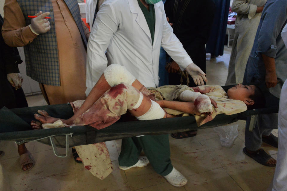 An injured boy is carried in a hospital following a bombing attack on a funeral for a local police commander in Nangarhar, Afghanistan, May 12, 2020. / Credit: NOORULLAH SHIRZADA/AFP/Getty