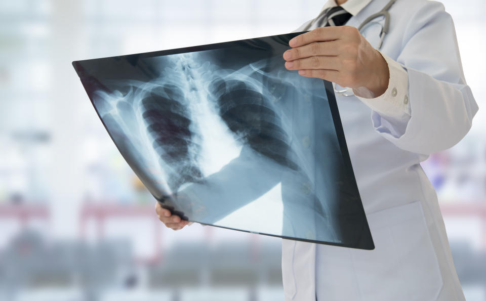 Doctor examining chest x-ray film of patient at hospital.