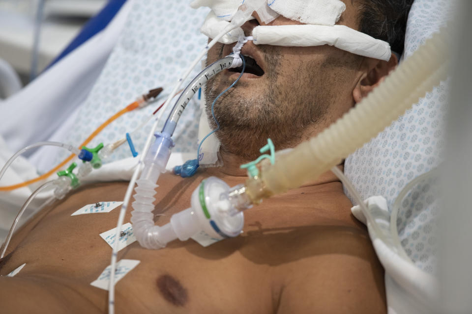 An intubated COVID-19 patient is treated in the ICU of a field hospital built inside a gym in Santo Andre, on the outskirts of Sao Paulo, Brazil, Thursday, March 4, 2021. (AP Photo/Andre Penner)