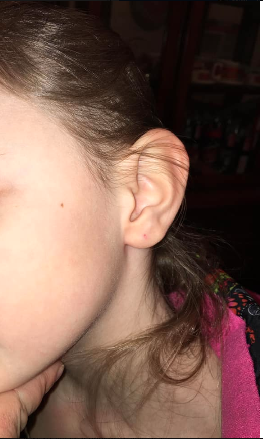 A mum has claimed a teacher pierced her seven-year-old daughter's ear at school. Photo: Facebook