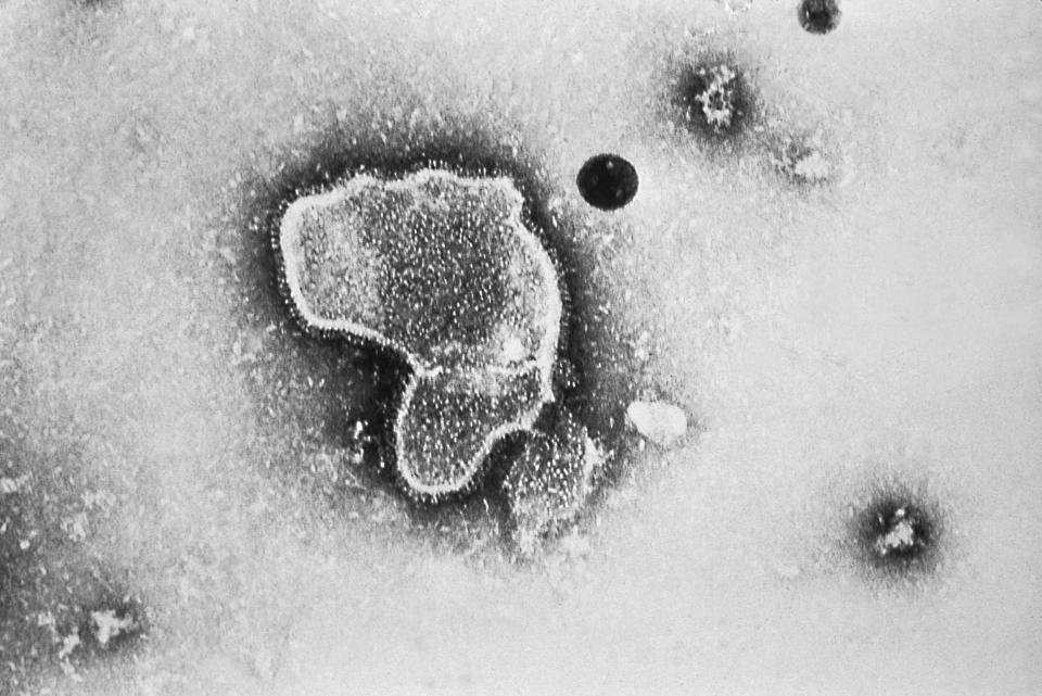 Image: A highly-magnified transmission electron microscopic image of the human respiratory syncytial virus (RSV). (E.L. Palmer / CDC)