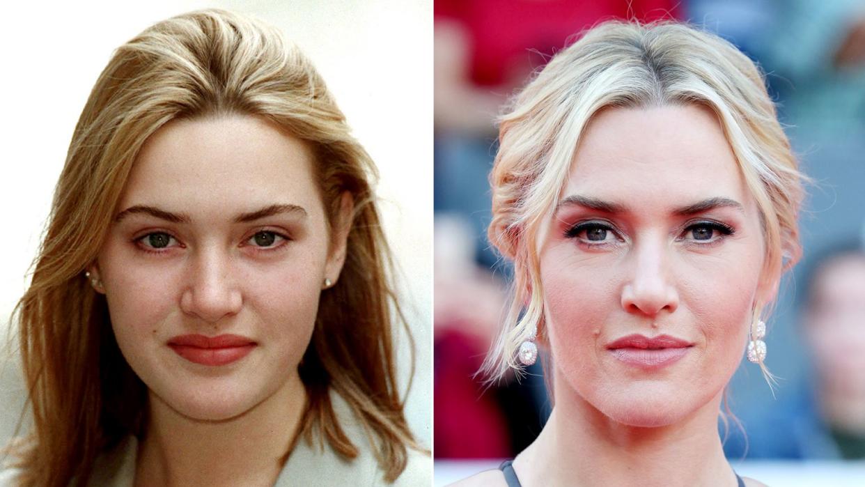 Kate Winslet Transformation Lead