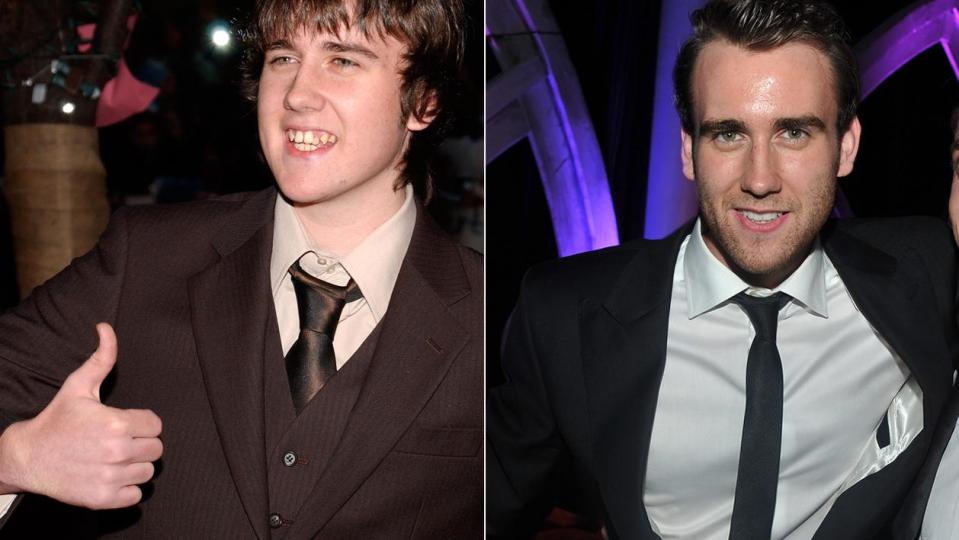 The best male celeb glo-ups