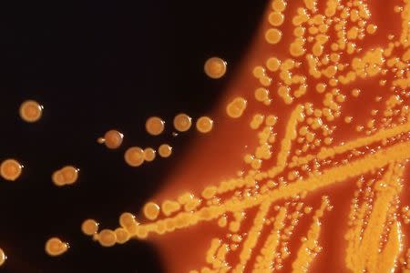 Colonies of E. coli bacteria grown on a Hektoen enteric (HE) agar plate are seen in a microscopic image courtesy of the U.S. Centers for Disease Control (CDC). CDC/Handout via REUTERS