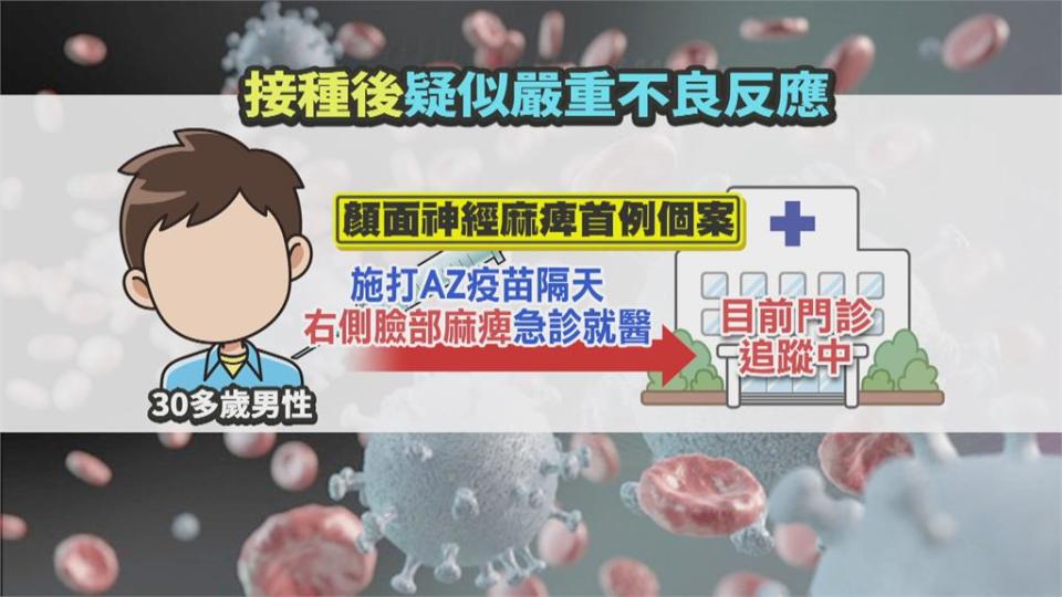 全台首例！ 30多歲男打完疫苗 隔日右臉麻痺