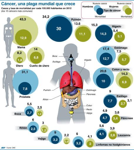 Los casos en el mundo de los diferentes tipos de cáncer por género (175 x 195 mm) (AFP | L.Saubadu/J.Storey, jfs/jj/vl/pld/adc)